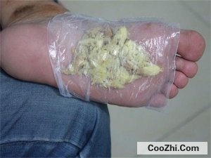 婴儿流鼻涕用姜敷脚心有没有用优质