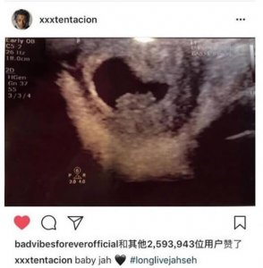 XXXtentacion儿子照片首曝光，取名Gekyume(和X非常像)